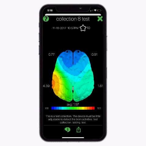 Viewing Brain Maps in Opti Brain