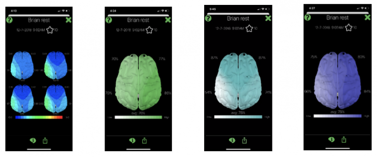 best 2nd brain app best 2nd brain app